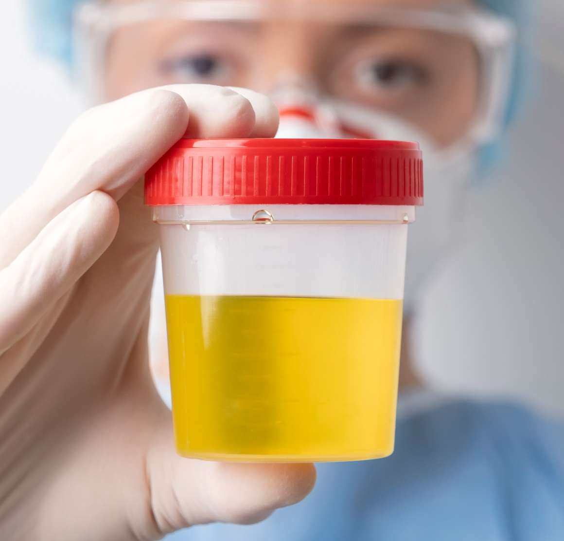 how-long-is-cbd-detectable-in-urine.jpg