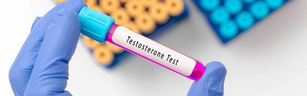 Test und Überwachung des Testosteronspiegels