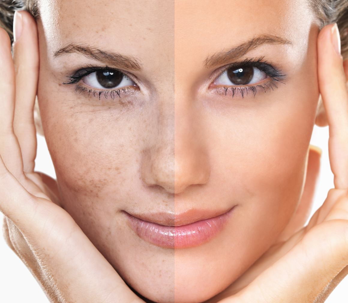When can you expect to see collagen results?