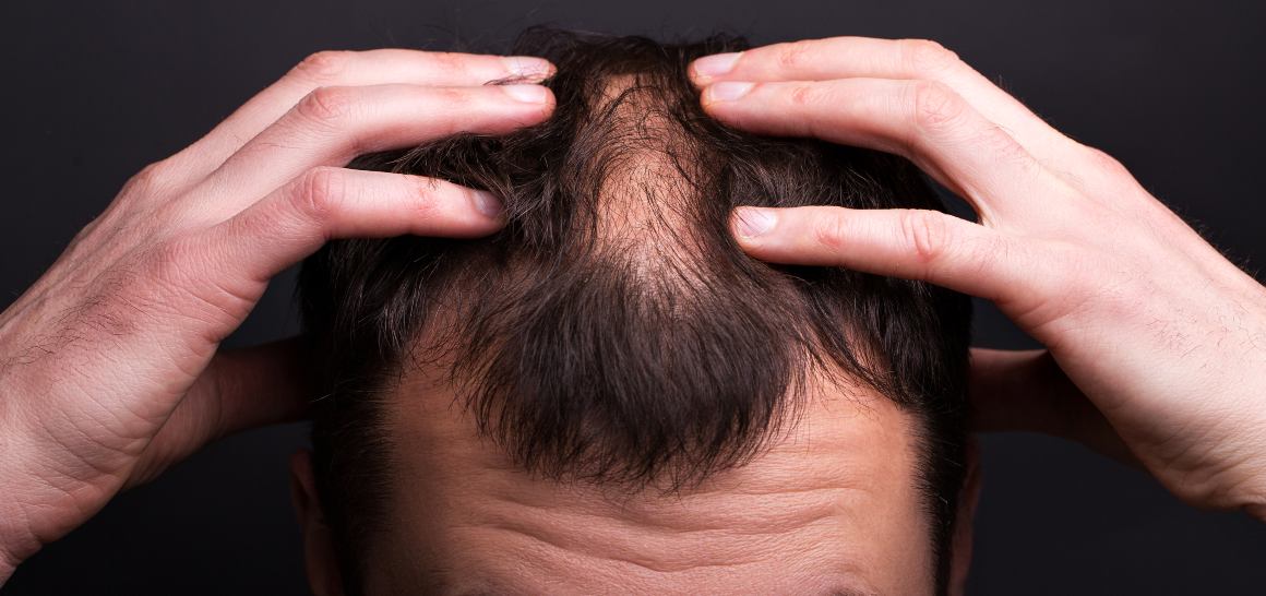 L'olio di CBD può aiutare i capelli a crescere?