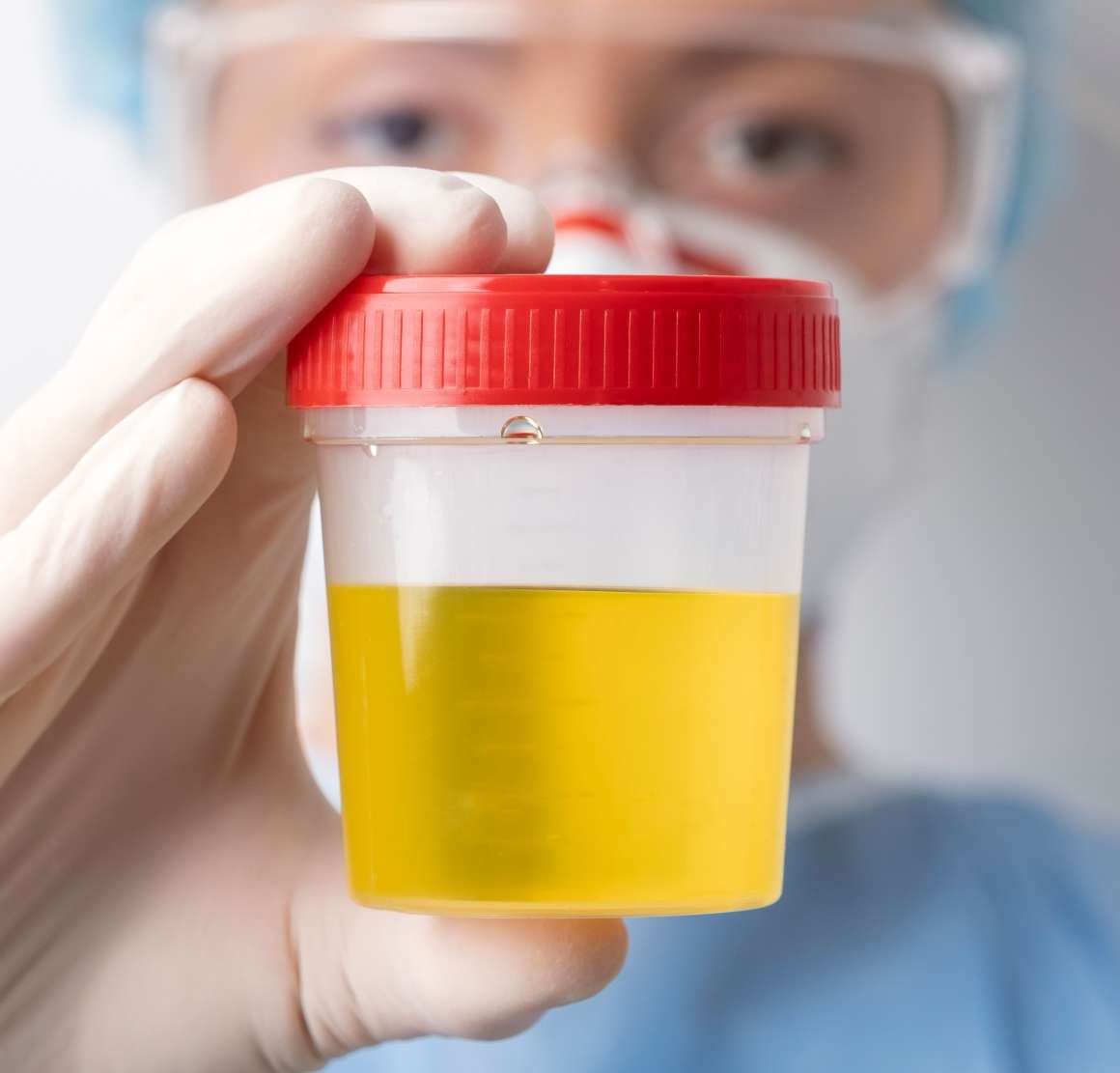 Per quanto tempo la CBD è rilevabile nell'urina?