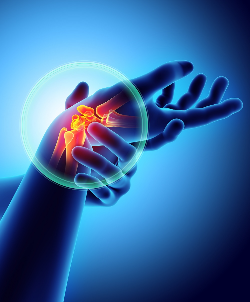 Cannabis Helps With Arthritis Pain And Inflammation?