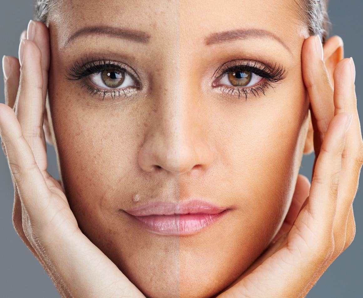 How can i reverse my face aging? 