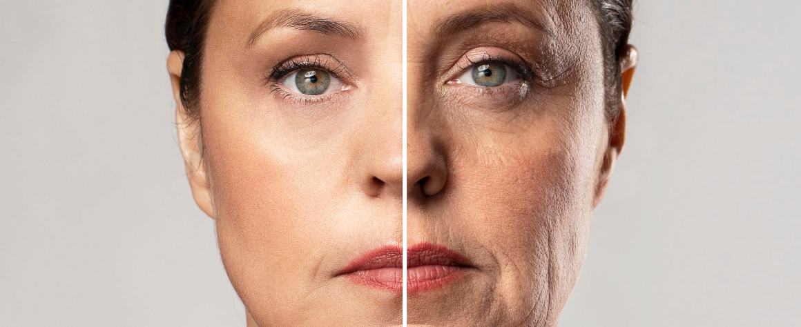 Can face wrinkles be reversed? 