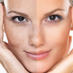 When can you expect to see collagen results?