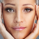 How can i reverse my face aging? 