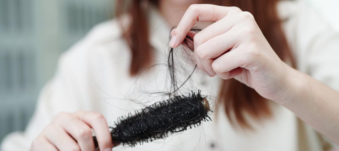Malnutrition can lead to hair loss